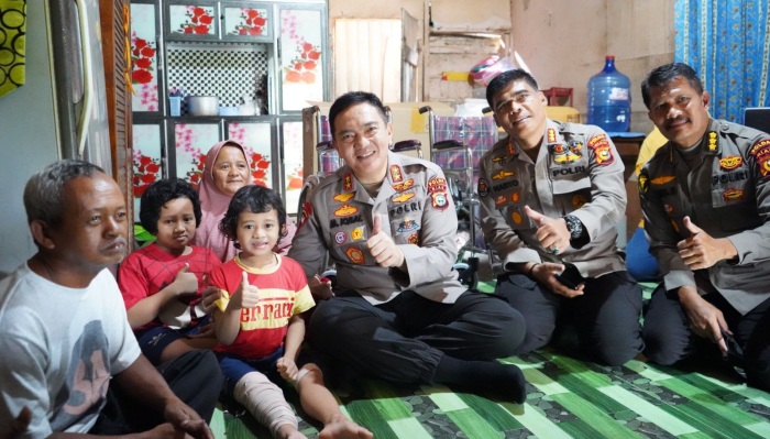 Dua Adik Beradik di Pekanbaru Menderita Rapuh Tulang, Kapolda Riau Irjen Iqbal Berjanji Lakukan Intervensi Pengobatannya.